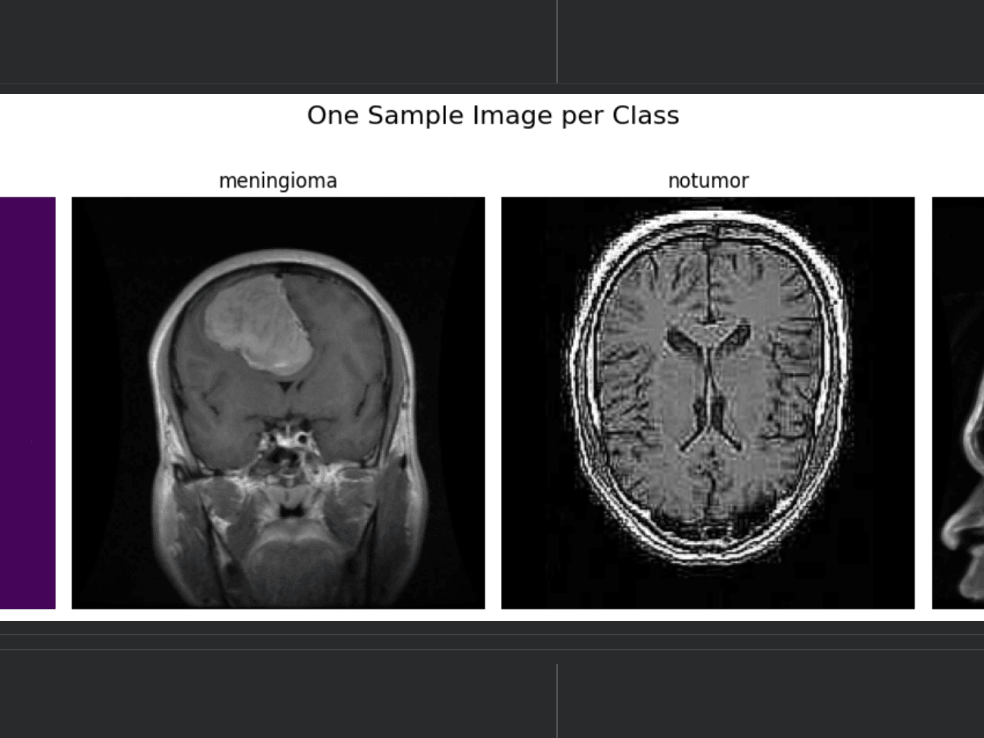 Brain Tumour Classification screenshot